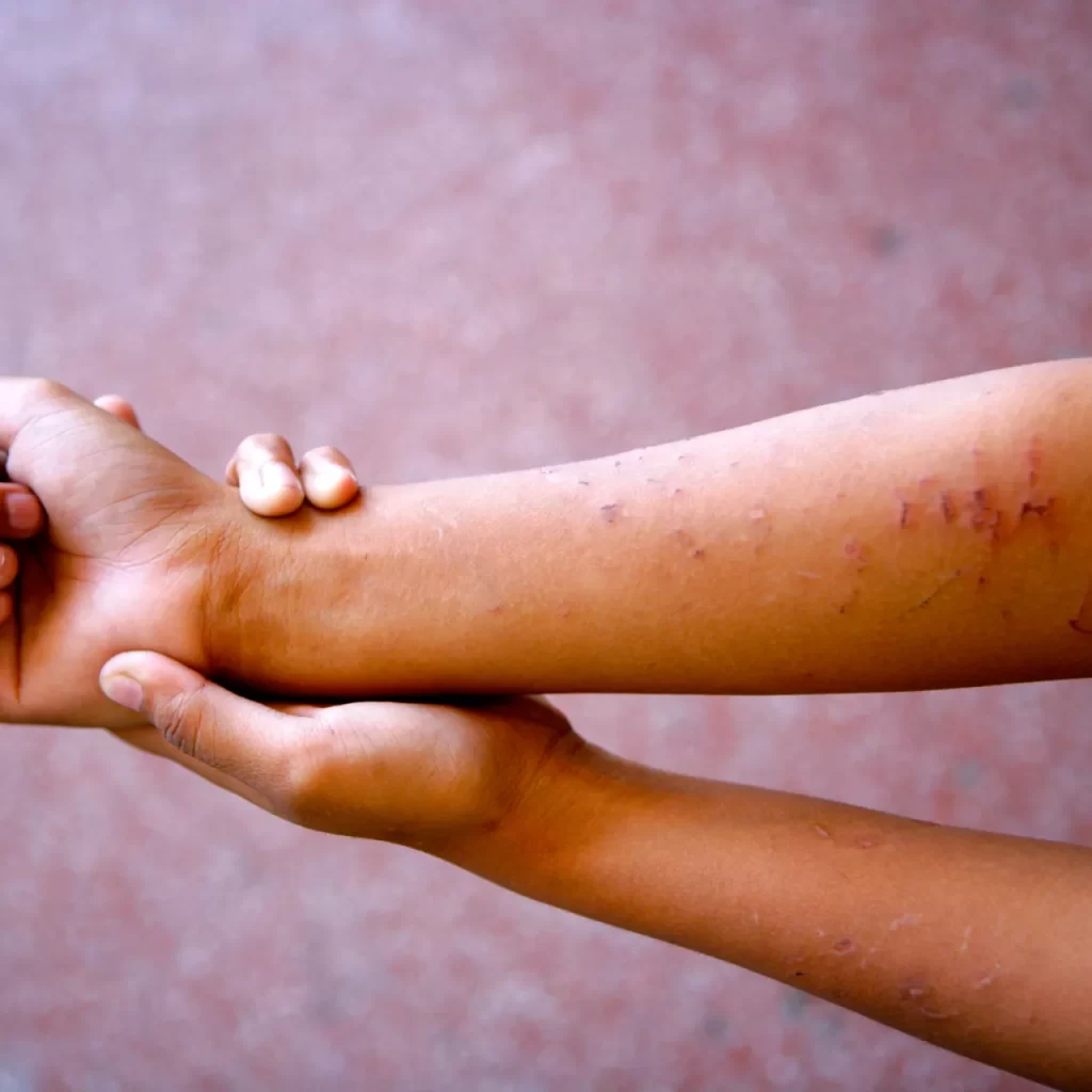 Más del 60% de los niños dominicanos sufre violencia en el hogar, alerta Unicef